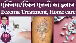 Eczema Treatment In Hindi | एक्ज़ेमा का इलाज | Skin Allergy, Dermatitis Treatment | Dermatologist screenshot 4