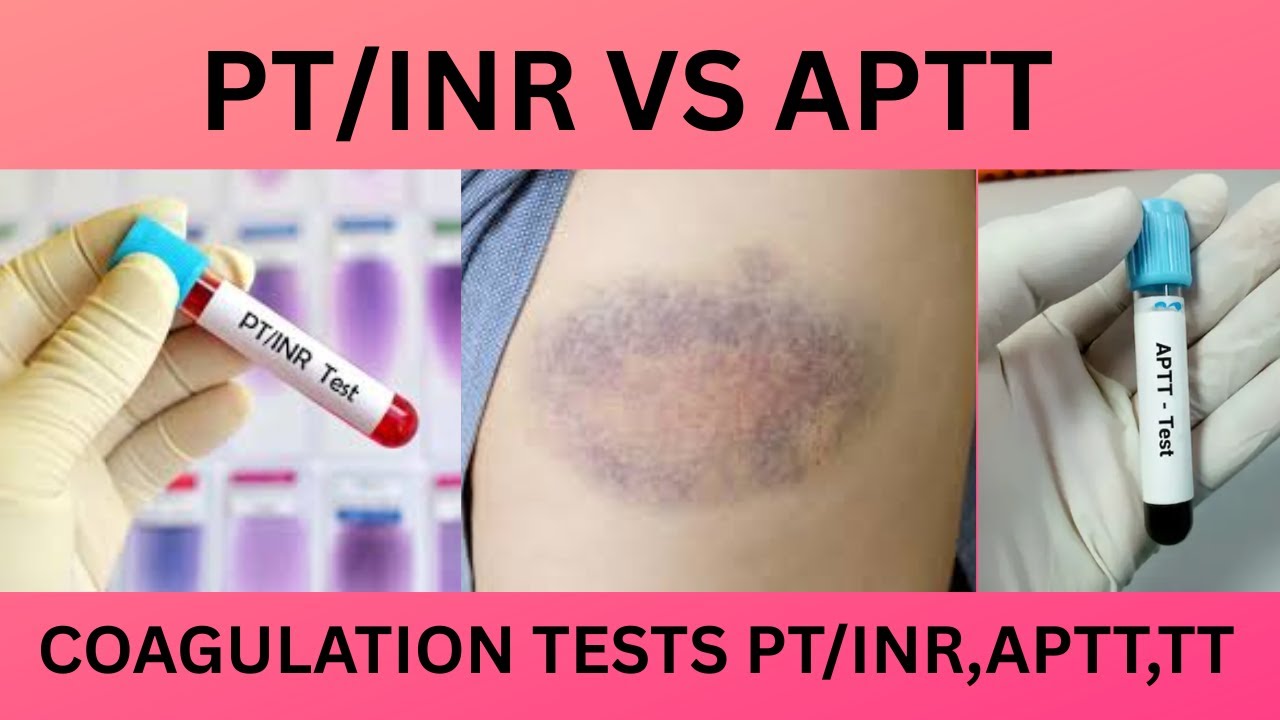 PT/INR VS APTT. DIFFERENCE BETWEEN PROTHROMBIN TIME(PT) VS ACTIVATED ...