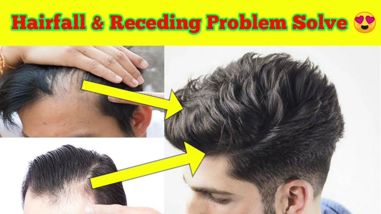 How To Control Hair Fall How To Control Hair Fall Naturally At Home