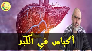 وصفات طبيعية لعلاج الكيس  المائي في الكبد وتنقيته  -  الدكتور كريم العابد العلوي  -