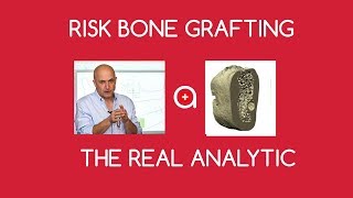 FAQ N°1: Risk of bone grafting by Prof. Ihde