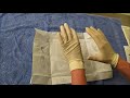 Open Surgical Gloving Techniques and Sizing