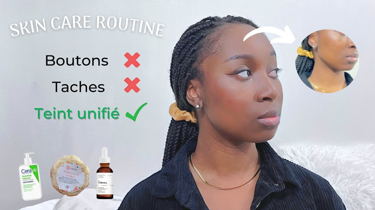 Comment avoir une belle peau sans BOUTONS et sans TACHES | Astuces pour