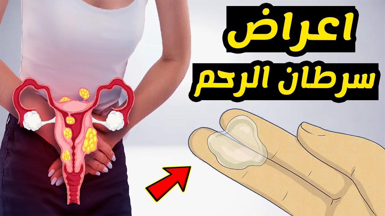 اعراض سرطان الرحم