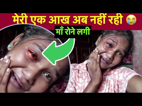 मेरी एक आख अब नहीं रही 😭😭 | माँ भी रोने लगी #nirjala #vlog #sad