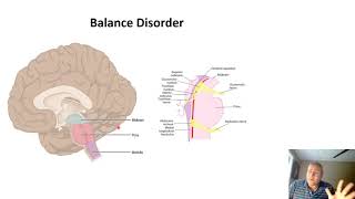 Balance Disorders After Head Injury