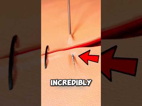 Needle Was Inspired By A Porcupine 