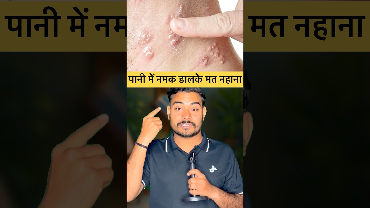 अब नहीं होगा hairfall and dandruf 