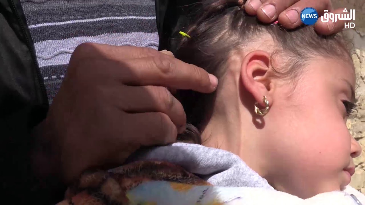 برج بوعريريج:  الطفلة آية ..  حلم المشي يصطدم بمرض الصلب المشقوق