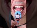 Satisfying Chewing ASMR #Compilation #ASMR #DoctorTristanPeh