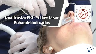 QuadrostarPRO Yellow laser  voor vasculaire en pigmentafwijkigen