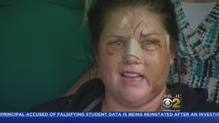 Survivor Of Brutal Attack To Face Rapist At Sentencing