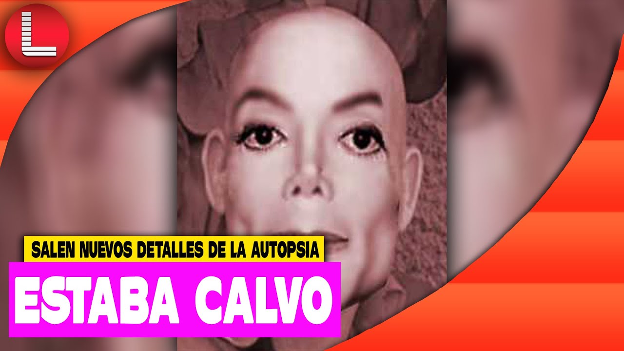Salen Nuevos Detalles De La Autopsia De Michael Jackson Estaba Calvo