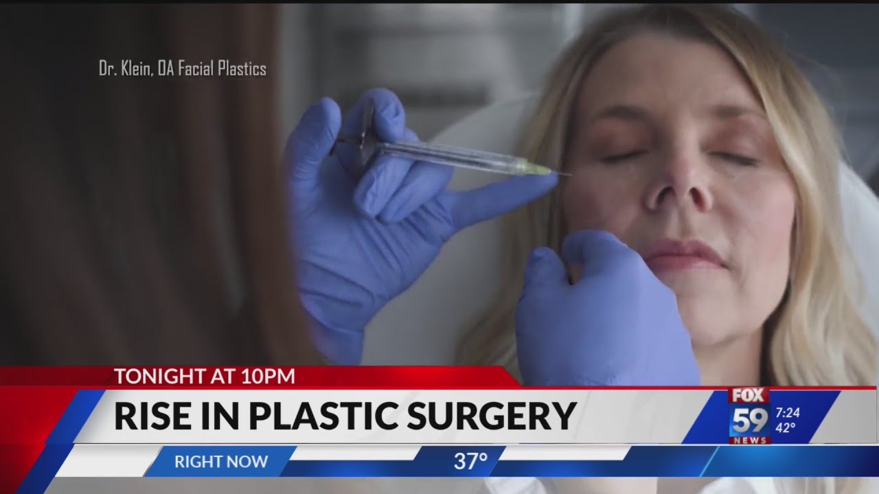 Rise in plastic surgery preview