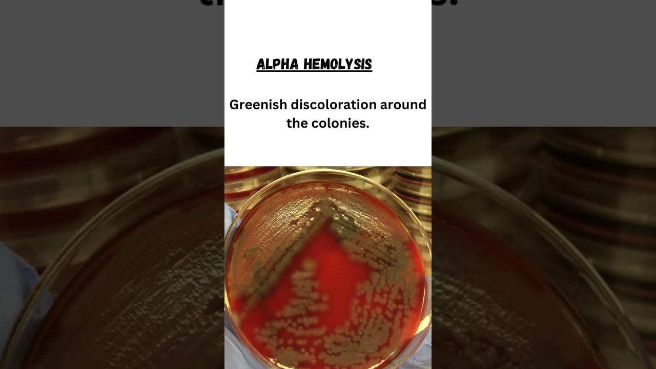 Types of hemolysis shown by bacteria on blood agar 