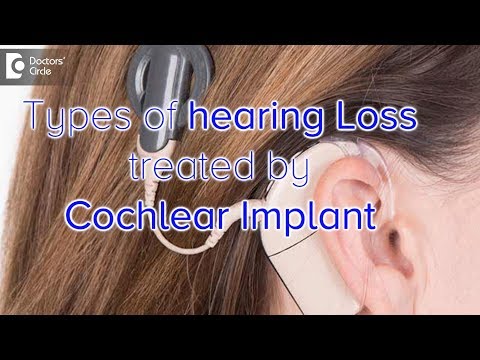 Which Type Of Hearing Loss Is Helped By Cochlear Implants
