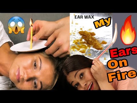 Most Dangerous☠Hack Tested Ears On🔥Fire|😱I Tried Ear Candle Wax|Be Natural