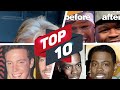 Celebrities With Fake Teeth 📌