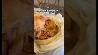 Gia Cerita Anatomi Eps. Rahim