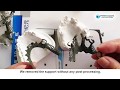 3D Printed Removable Partial Denture (RPD) by Farsoon FS121M Machine