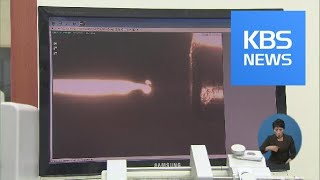 증상 없는 ‘조기발병 위암’…국내 연구진 원인 찾았다! / KBS뉴스(News)