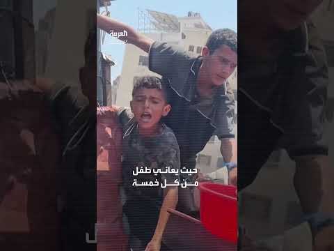 الأونروا: أوضاع إنسانية مأساوية في غزة