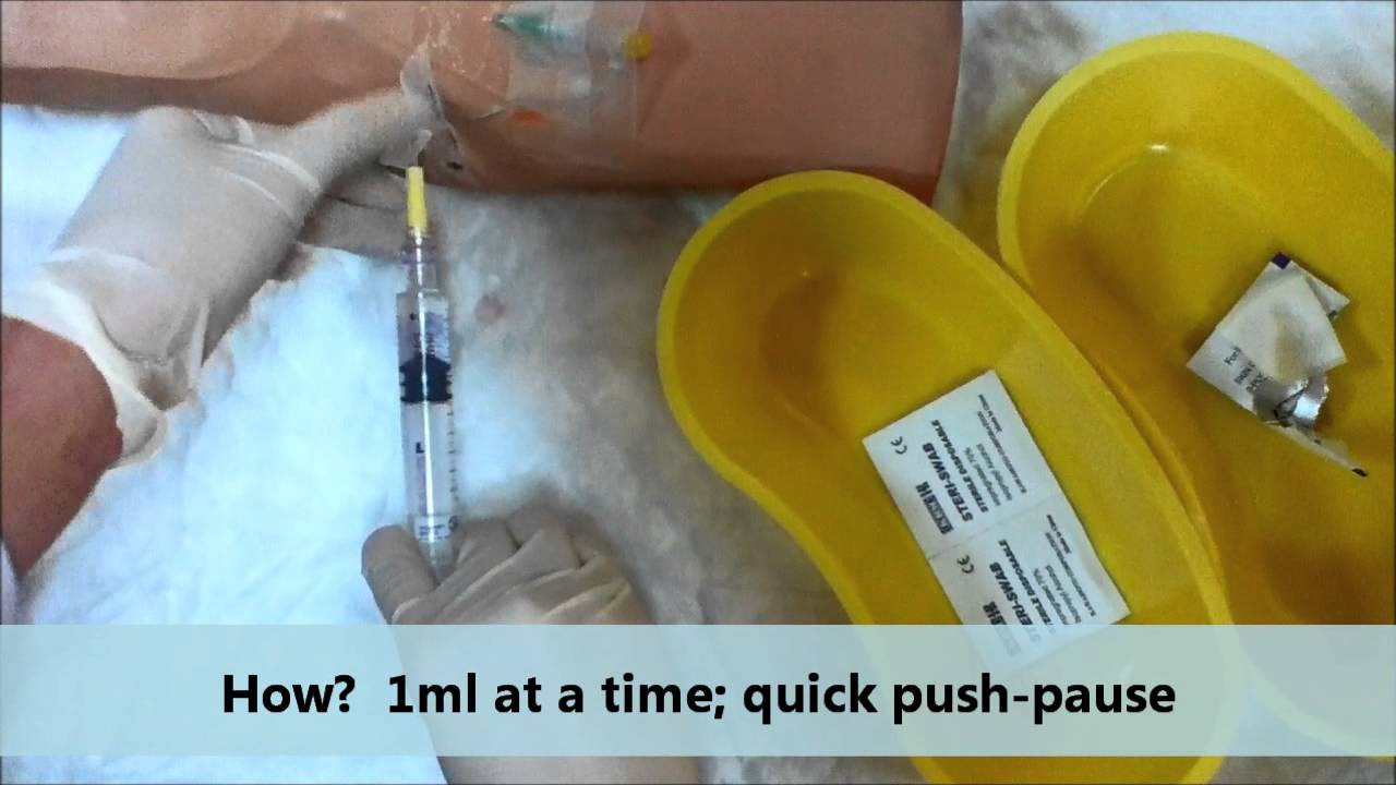 Flushing Technique By Iv Team KKUH YouTube flushing-technique-by-iv-team-kkuh-youtube
