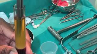 Platelet Rich Fibrin for various maxillofacial Surgeries @ Richardsons