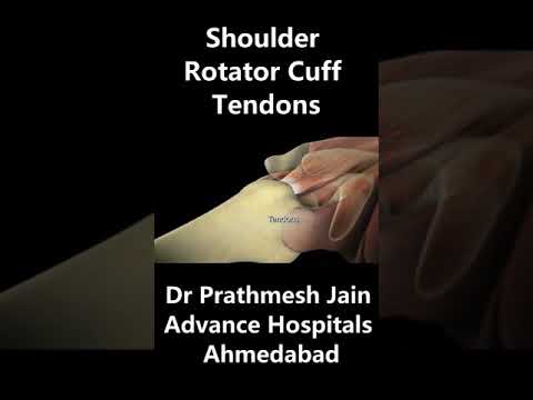 Video: Apakah tendinosis supraspinatus memerlukan pembedahan?