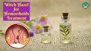How to Use Witch Hazel for Hemorrhoids Treatment? Witch Hazel Benefits for Hemorrhoids How to Use