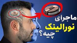 برای نصب تراشه روی مغزتان اماده شوید 🤯