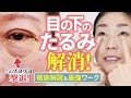 【完全版】目の下のぶよぶよ解消法