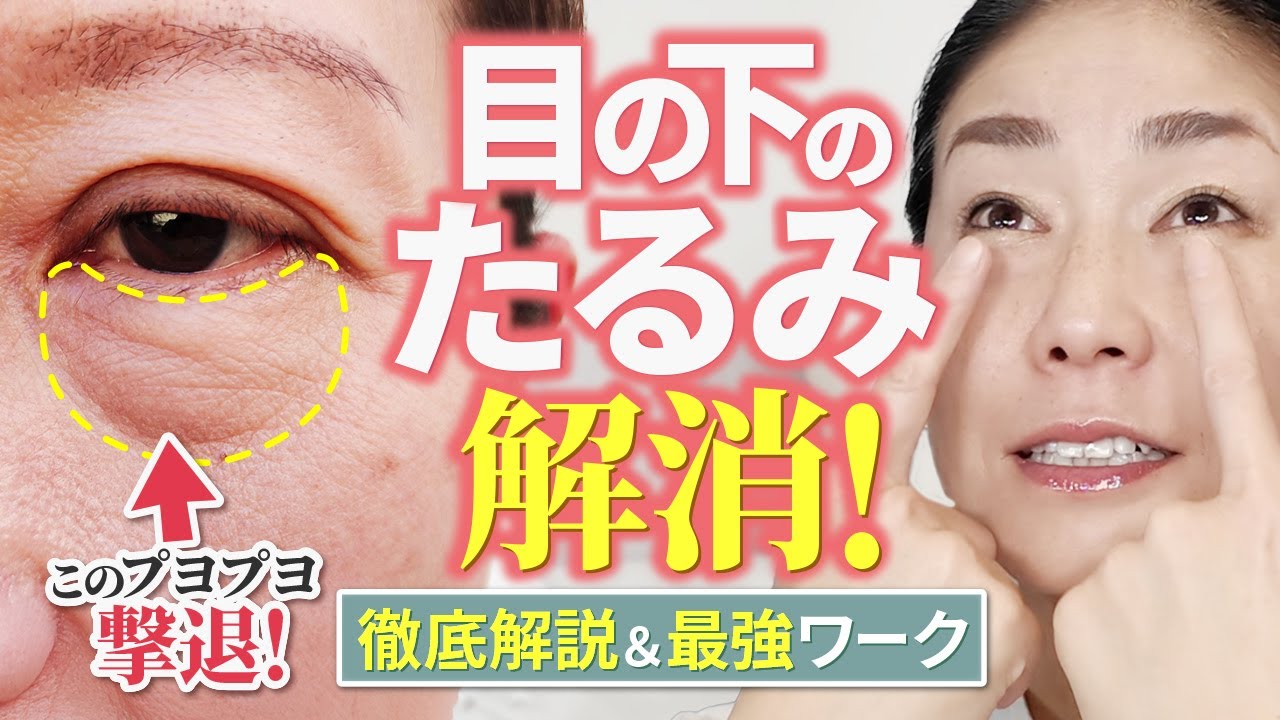 【完全版】目の下のぶよぶよ解消法