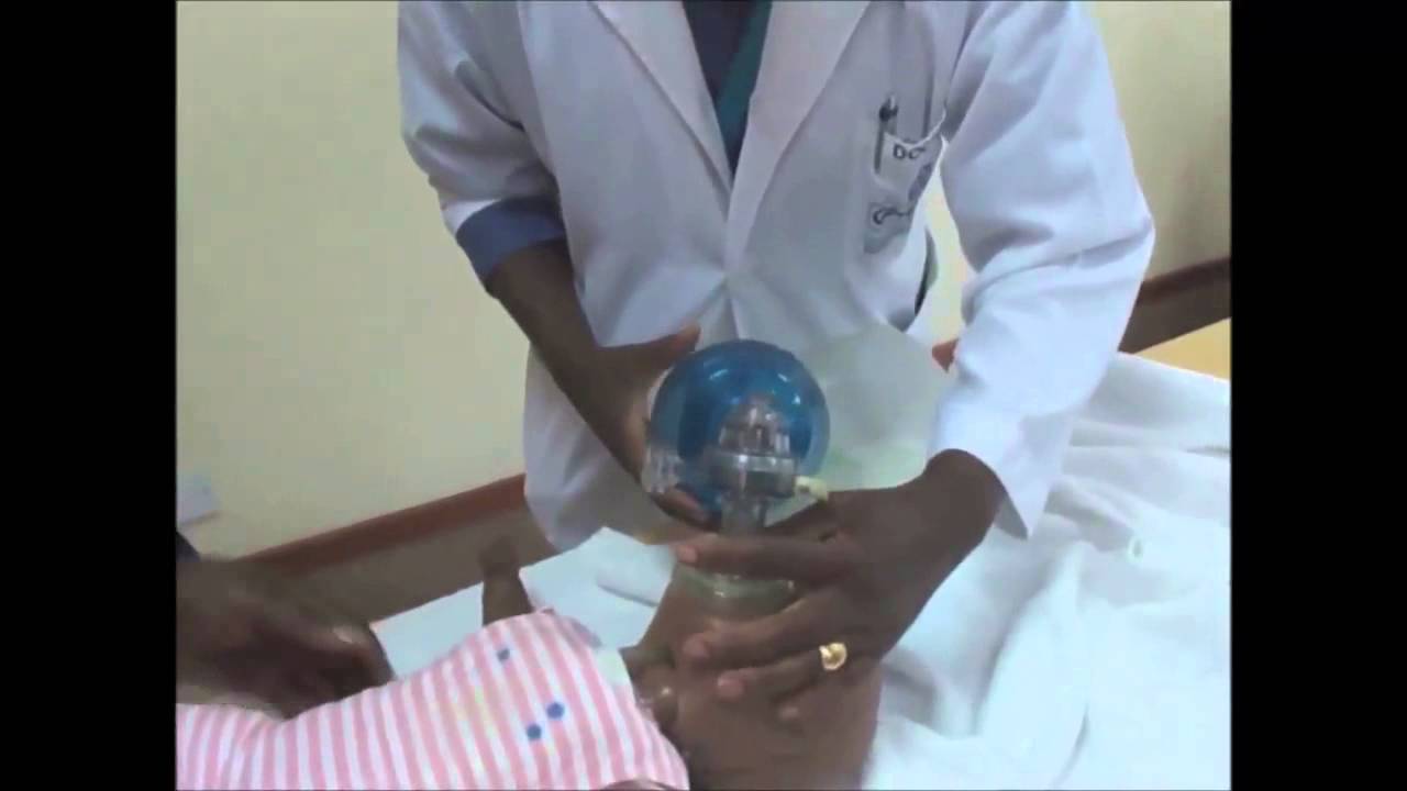 Tips On Resuscitation Of Newborns With Breathing Complications Youtube