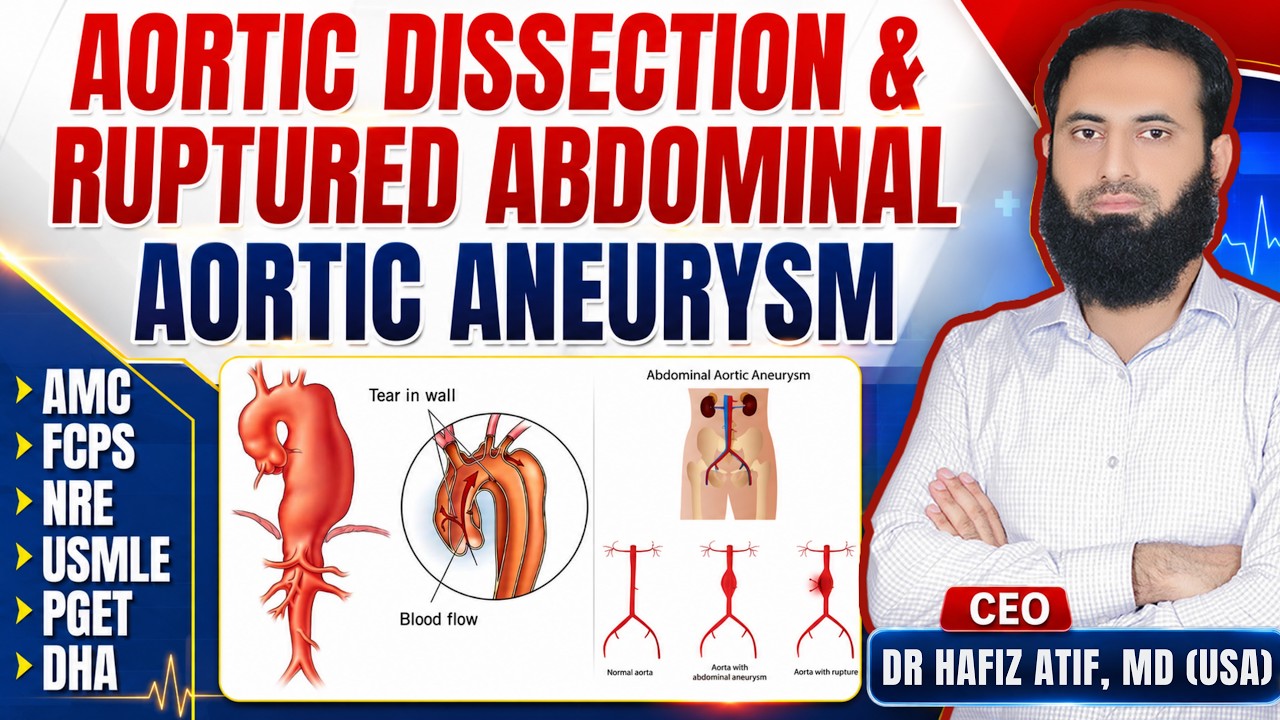 AORTIC DISSECTION & RUPTURED ABDOMINAL AORTIC ANEURYSM | High Yield Topic | Dr Hafiz Atif | FAME 
