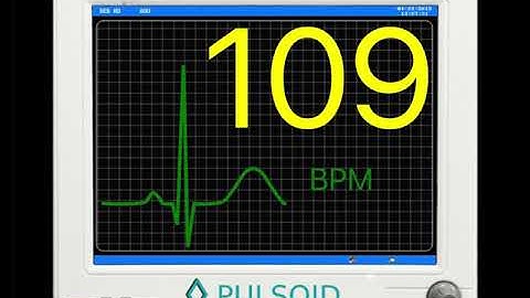 Medical Monitor Widget by Pulsoid for streaming
