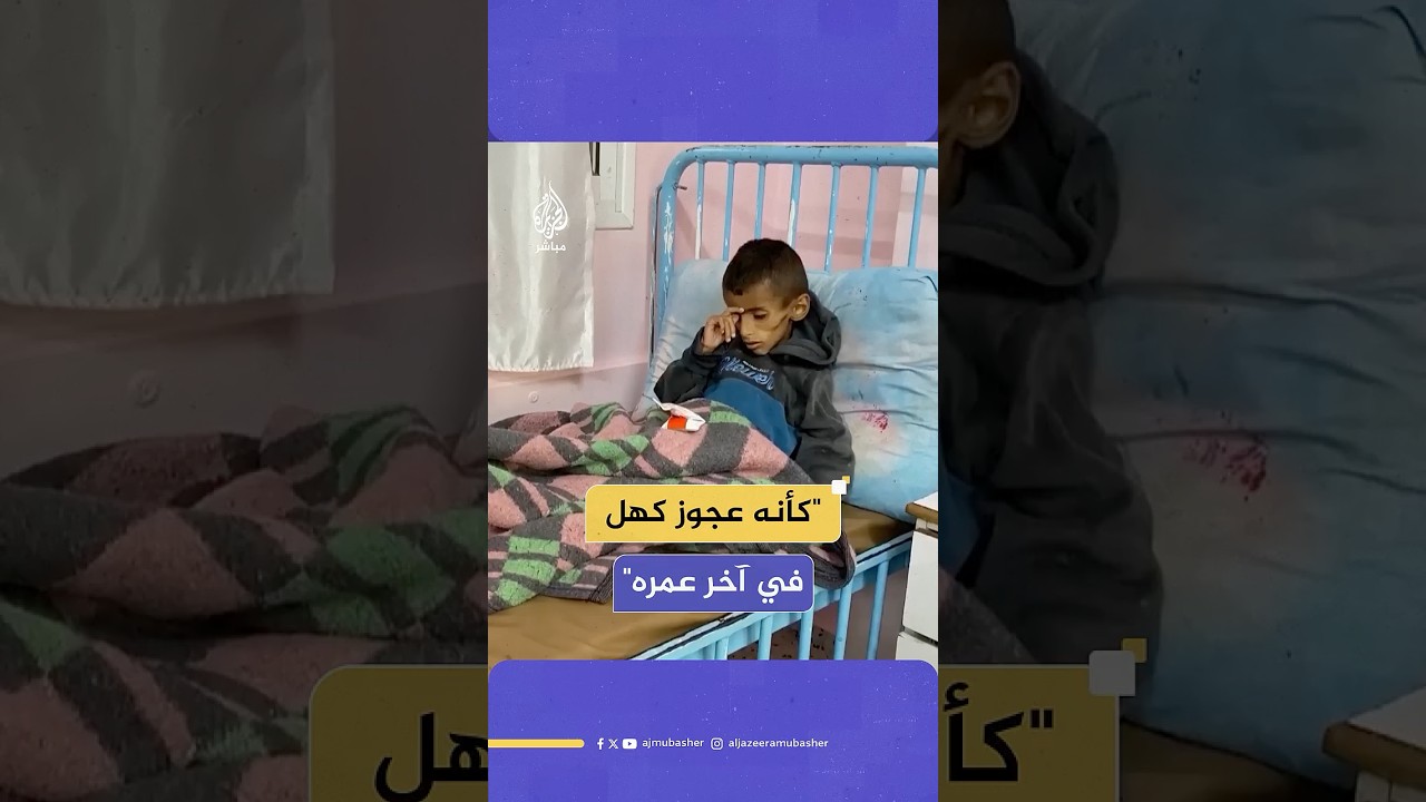 بسبب سوء التغذية وتفشي المجاعة في قطاع غزة.. الطفل أسامة الرقب يعيش معاناة أكبر من عمره