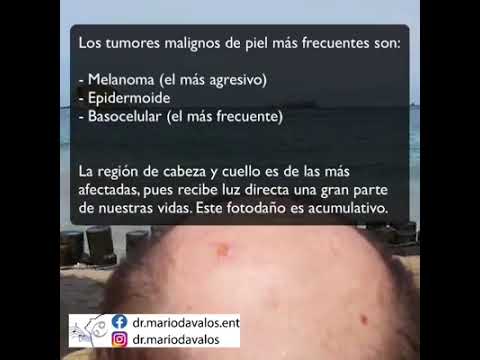 Cáncer de piel y cuello
