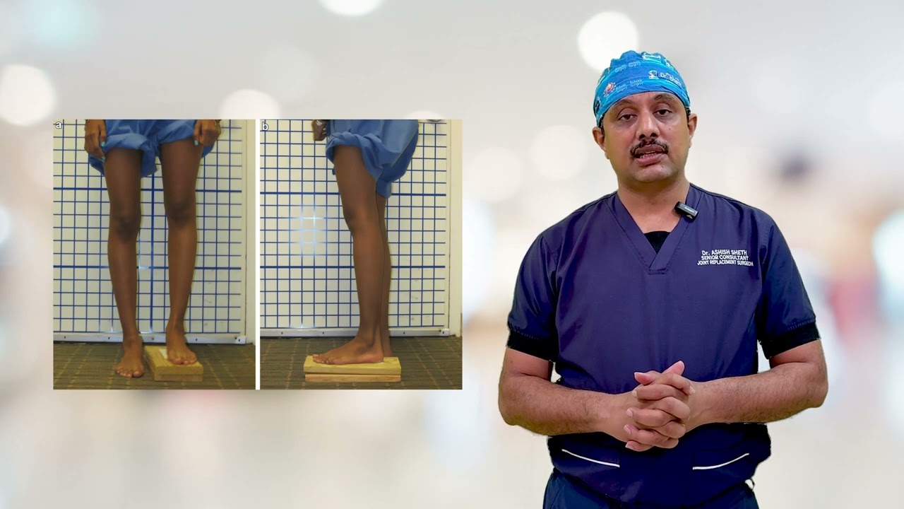 Why One Leg Feels Longer After Hip Replacement | Limb Length Discrepancy | Dr. Aashish Sheth