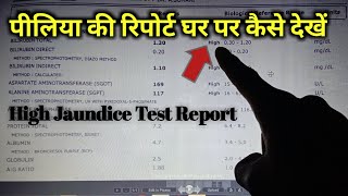bilirubin test (in hindi) !! पीलिया टेस्ट रिपोर्ट इन हिंदी !! Bilirubin Report, Jaundice Test Report
