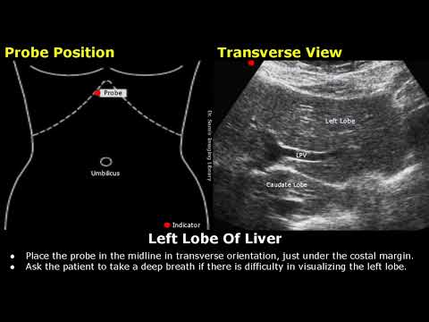 Abdominal, Gynecological & Obstetric Ultrasound Probe Positioning | Transducer Placement USG Scan