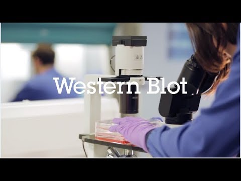 Video: Hvornår udføres en western blot-test?