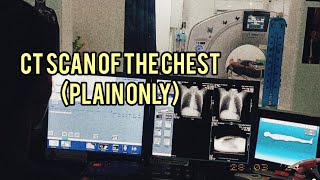 CHEST CT SCAN | Plain CT Scan of the Chest