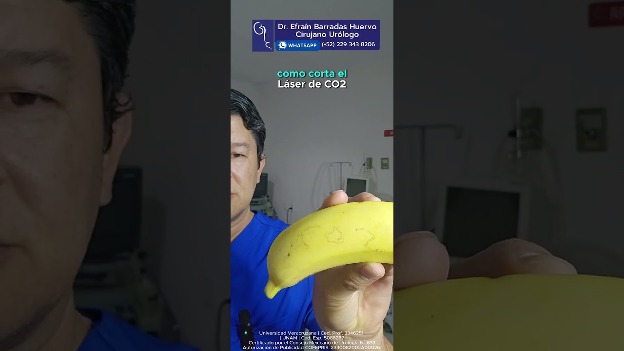 Cómo se lleva a cabo la circuncisión con Láser CO2  