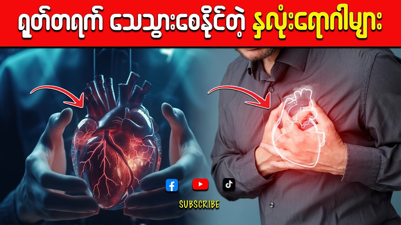 နှလုံးရောဂါ ရှေ့ပြေးလက္ခဏာများ (မြန်မာ ၅ ယောက်မှာ ၁ ယောက် နှလုံးရောဂါခံစားနေရပါတယ်) မပေါ့ဆပါနဲ့