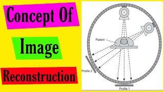 Concept Of Image Reconstruction in CT | Basics Of CT | Radiology Classes in Hindi