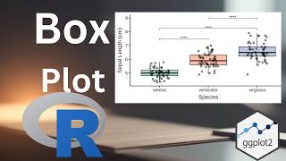 How to prepare boxplot in R with significance
