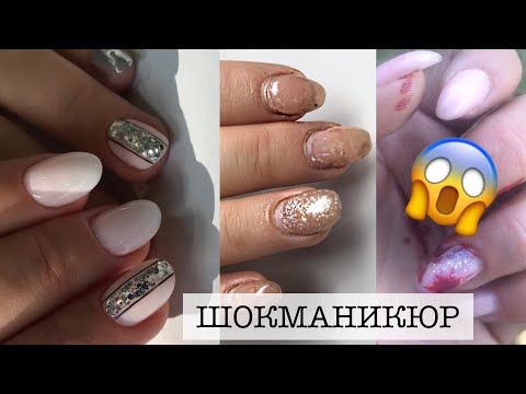 СОБАКА ОТОРВАЛА НОГОТЬ | КЛИЕНТКА ПАРИКМАХЕР | спасаю ногти | ШОКМАНИКЮР | Patrisa Nail