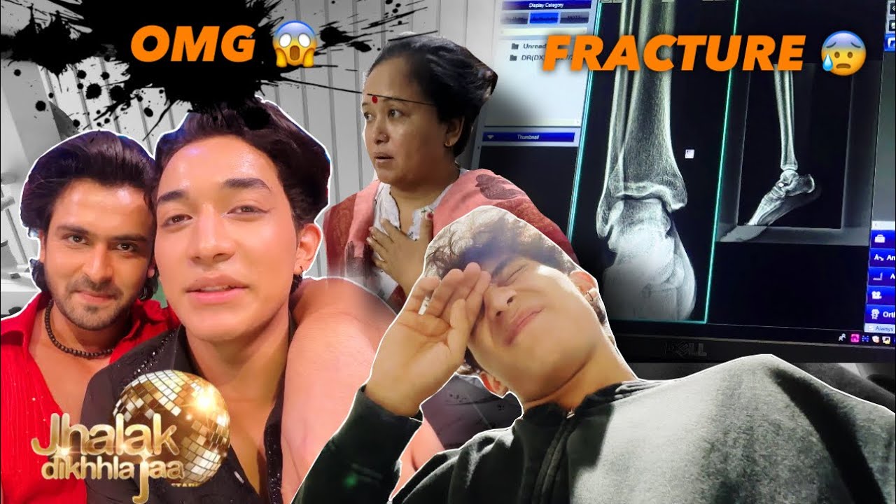 Did I Break My Leg 😰 Worst Day 😓