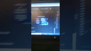 Gross Salary/ Codechef solution